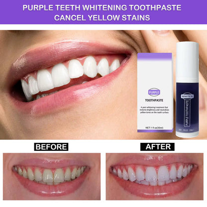 Dentifrice Violet Blanchissant – Sourire Éclatant en Quelques Utilisations