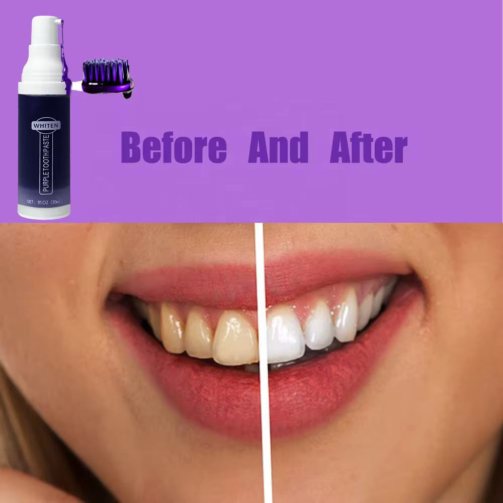 Dentifrice Violet Blanchissant – Sourire Éclatant en Quelques Utilisations
